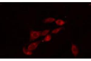 ABIN6274115 staining 293 cells by IF/ICC. (PFKFB2 anticorps  (C-Term))