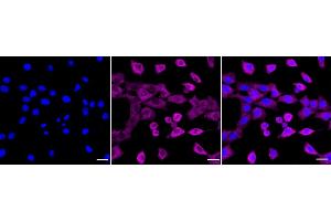 Immunocytochemical staining of C2C12 cells with RELB antibody (ABIN7800804), 1:1,000). (Recombinant RELB anticorps)