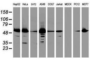 Image no. 1 for anti-Epoxide Hydrolase 1, Microsomal (Xenobiotic) (EPHX1) (AA 21-230) antibody (ABIN1491197) (EPHX1 anticorps  (AA 21-230))