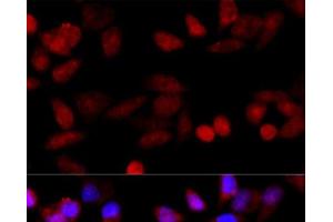 Immunofluorescence analysis of HeLa cells using CYP1B1 Polyclonal Antibody at dilution of 1:100 (40x lens). (CYP1B1 anticorps)