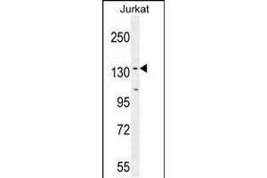 Western blot analysis in Jurkat cell line lysates (35ug/lane). (PPP1R3A anticorps  (AA 754-782))