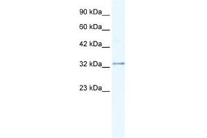 WB Suggested Anti-NUDT9 Antibody Titration:  0. (NUDT9 anticorps  (C-Term))