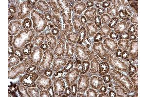 IHC-P Image ROCK2 antibody detects ROCK2 protein at cytosol on mouse kidney by immunohistochemical analysis. (ROCK2 anticorps)