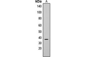 Western blot analysis of CD79b expression in Raji (A), K562 (B) whole cell lysates. (CD79b anticorps  (Center))