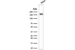 Western Blot Analysis of human HeLa cell lysate using Topoisomerase II alpha, Monoclonal Antibody (TOP2A/1361).