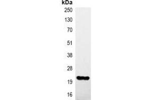 Immunoprecipitation of HA-tagged protein from HEK293T cells transfected with vector overexpressing HA tag, using Anti-HA-tag Antibody. (HA-Tag anticorps)