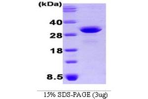 Osteoclast Stimulating Factor 1 (OSTF1) (AA 1-217) protein (His tag)