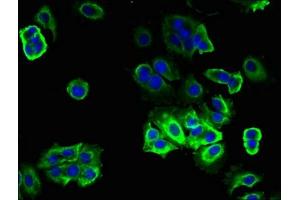 anti-Translocation Associated Membrane Protein 2 (TRAM2) (AA 316-370) antibody