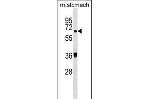 TDP1 Antibody (Center) (ABIN1538086 and ABIN2849232) western blot analysis in mouse stomach tissue lysates (35 μg/lane). (TDP1 anticorps  (AA 212-239))