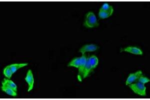 Immunofluorescent analysis of MCF-7 cells using ABIN7158547 at dilution of 1:100 and Alexa Fluor 488-congugated AffiniPure Goat Anti-Rabbit IgG(H+L) (FCGR3A anticorps  (AA 49-184))