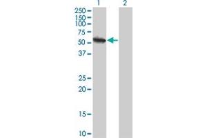 Western Blot analysis of USP3 expression in transfected 293T cell line by USP3 monoclonal antibody (M01), clone 1H2. (USP3 anticorps  (AA 421-520))