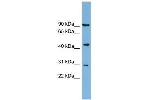 Western Blot showing TUSC4 antibody used at a concentration of 1-2 ug/ml to detect its target protein.