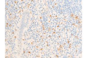 ABIN6267302 at 1/100 staining human appendiceal tissue sections by IHC-P.