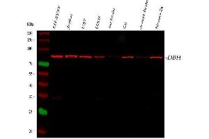 Western blot analysis of DBH using anti-DBH antibody (ABIN7601651).