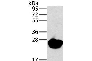 Western Blot analysis of Mouse heart tissue using MYL3 Polyclonal Antibody at dilution of 1:650 (MYL3/CMLC1 anticorps)