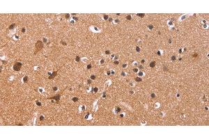 Immunohistochemistry of paraffin-embedded Human brain tissue using CSNK1D Polyclonal Antibody at dilution 1:50
