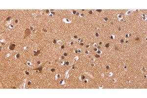 Immunohistochemistry of paraffin-embedded Human brain tissue using CSNK1D Polyclonal Antibody at dilution 1:50 (Casein Kinase 1 delta anticorps)