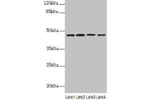 Western blot All lanes: NAPEPLD antibody at 6 μg/mL Lane 1: Mouse large intestine tissue Lane 2: Mouse kidney tissue Lane 3: Mouse stomach tissue Lane 4: MCF-7 whole cell lysate Secondary Goat polyclonal to rabbit IgG at 1/10000 dilution Predicted band size: 46 kDa Observed band size: 46 kDa (NAPEPLD anticorps  (AA 1-200))