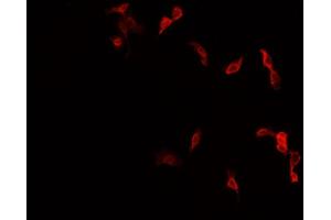 ABIN6277998 staining HepG2? (NR4A1 anticorps  (Internal Region))