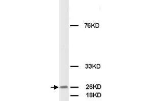 Western Blot analysis of FGF8 expression from MCF-7 cell lyate with FGF8 polyclonal antibody . (FGF8 anticorps  (C-Term))