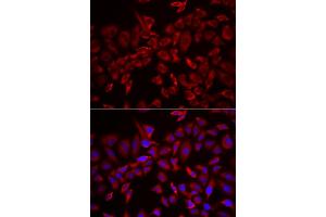 Immunofluorescence analysis of HeLa cells using CSRP3 antibody (ABIN6291316).