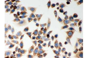 IHC analysis of CARD4  using anti-CARD4  antibody .
