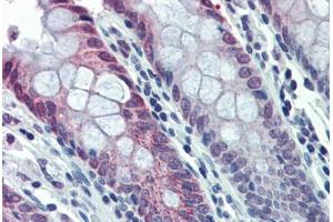 Human Colon: Formalin-Fixed, Paraffin-Embedded (FFPE)