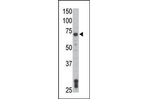 Image no. 2 for anti-TXK tyrosine Kinase (TXK) (N-Term) antibody (ABIN359999) (TXK anticorps  (N-Term))
