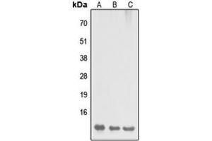 Western blot analysis of DYNLL2 expression in HEK293T (A), Raw264. (DYNLL2 anticorps  (N-Term))