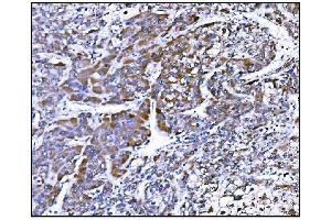 IHC analysis of Prolyl Endopeptidase/PREP using anti-Prolyl Endopeptidase/PREP antibody (ABIN7599118).