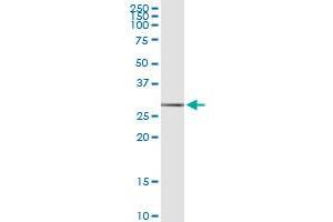 LCN2 (Human) IP-WB Antibody Pair