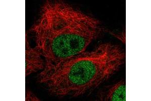 Immunofluorescent staining of A-549 cells with ZEB1 monoclonal antibody, clone CL0151  (Green) shows nuclear (without nucleoli). (ZEB1 anticorps)
