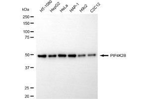 Western blotting analysis using PIP4K2B antibody (ABIN7799796).