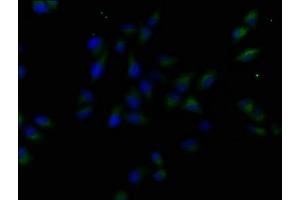 Immunofluorescence staining of Hela cells with ABIN7158896 at 1:50, counter-stained with DAPI. (MST1R anticorps  (AA 1175-1400))
