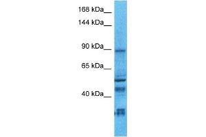 Host:  Rabbit  Target Name:  NLGN2  Sample Type:  Uterus Tumor lysates  Antibody Dilution:  1. (Neuroligin 2 anticorps  (C-Term))