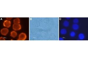 Expression of OX2R in human colon cancer cells - Immunocytochemical staining of paraformaldehyde-fixed and permeabilized human Colo-205 colon cancer cells using Anti-Orexin Receptor 2 Antibody (ABIN7043029, ABIN7044885 and ABIN7044886), (1:500), followed by goat-anti-rabbit-AlexaFluor-555 secondary antibody (red).