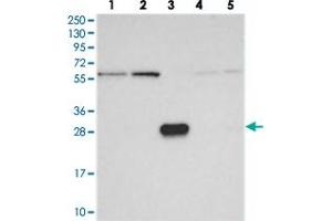 Western blot analysis of Lane 1: RT-4, Lane 2: U-251 MG, Lane 3: Human Plasma, Lane 4: Liver, Lane 5: Tonsil with KIAA1128 polyclonal antibody  at 1:250-1:500 dilution. (FAM190B anticorps)