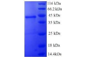 Non-Metastatic Cells 1, Protein (NM23A) Expressed in (NME1) (AA 2-152), (full length) protein (GST tag)