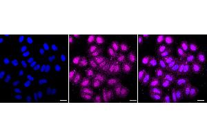 Immunocytochemical staining of HepG2 cells with DYNLL1 antibody (ABIN7798403), 1:1,000).