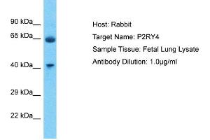 Host: Rabbit Target Name: P2RY4 Sample Type: Fetal Lung lysates Antibody Dilution: 1. (P2RY4 anticorps  (C-Term))