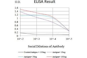 Black line: Control Antigen (100 ng),Purple line: Antigen (10 ng), Blue line: Antigen (50 ng), Red line:Antigen (100 ng) (SARS-CoV-2-NP3 (AA 240-419) anticorps)