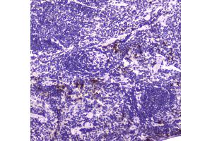 IHC analysis of Lactoferrin using anti-Lactoferrin antibody .