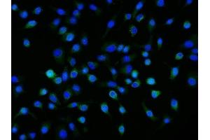 IF analysis of Neuropilin 1 using anti-Neuropilin 1 antibody (ABIN7601921).
