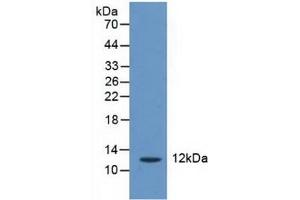 Detection of CRADD in Human Liver Tissue using Polyclonal Antibody to CASP2 And RIPK1 Domain Containing Adaptor With Death Domain Protein (CRADD)