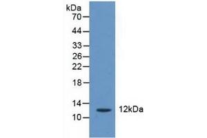 Detection of CRADD in Human Liver Tissue using Polyclonal Antibody to CASP2 And RIPK1 Domain Containing Adaptor With Death Domain Protein (CRADD) (CRADD anticorps  (AA 1-199))