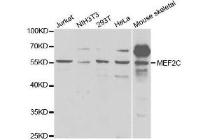 Western blot analysis of extracts of various cell lines, using MEF2C antibody. (MEF2C anticorps  (AA 170-380))
