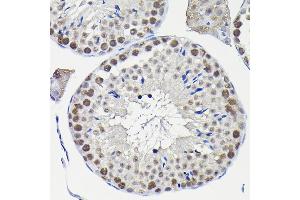 Immunohistochemistry of paraffin-embedded mouse testis using KPN Rabbit pAb (ABIN6131812, ABIN6142991, ABIN6142992 and ABIN6224371) at dilution of 1:100 (40x lens).