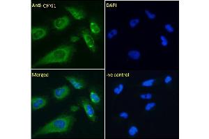 ABIN6391342 Immunofluorescence analysis of paraformaldehyde fixed U251 cells, permeabilized with 0. (IFT74 anticorps)