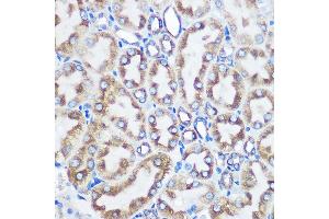 Immunohistochemistry of paraffin-embedded rat kidney using LOX Rabbit mAb (ABIN7268347) at dilution of 1:100 (40x lens).