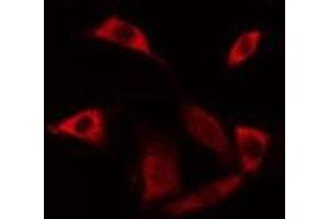 ABIN6275523 staining Hela cells by IF/ICC. (Septin 6 anticorps  (Internal Region))
